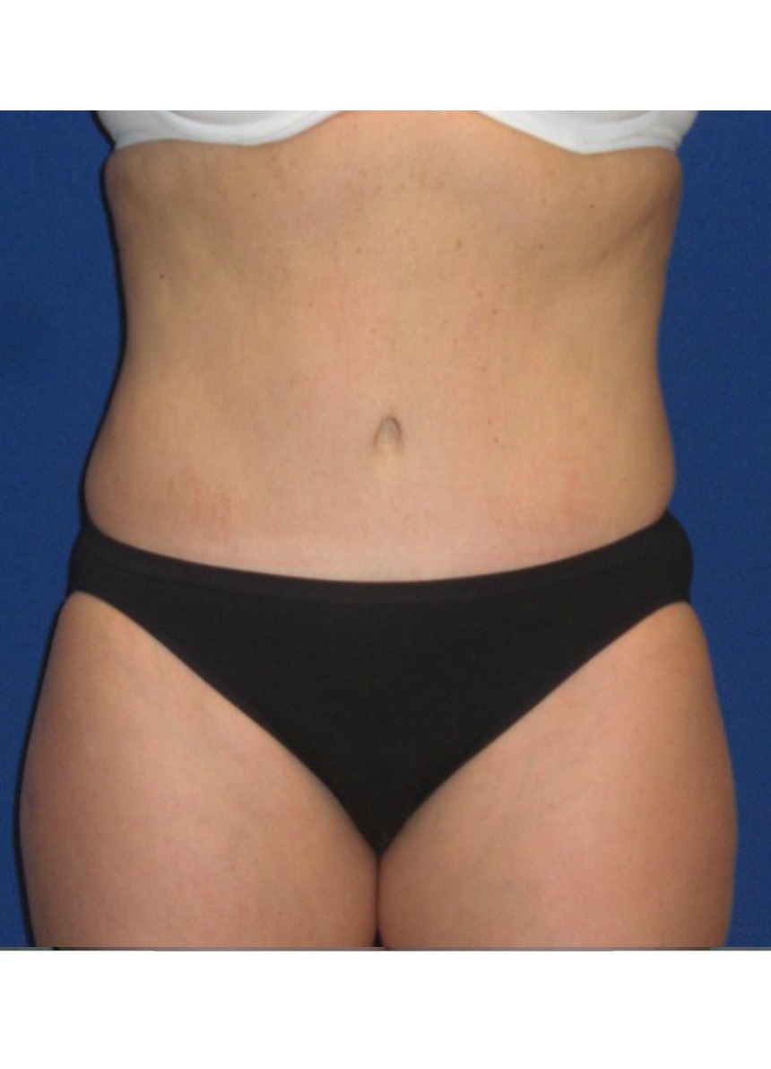 After Image