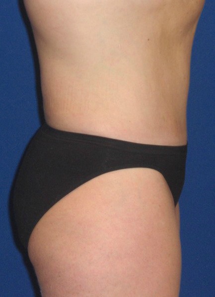 After Image