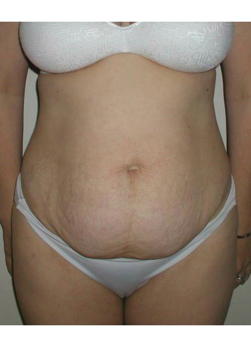 Before Image