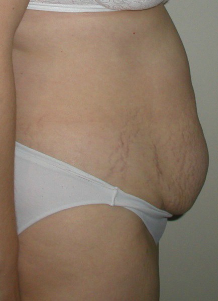 Before Image