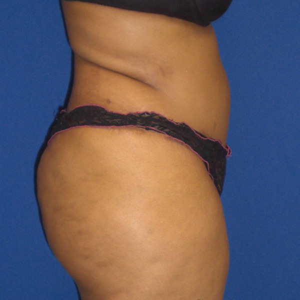 After Image