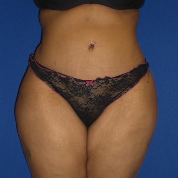 After Image