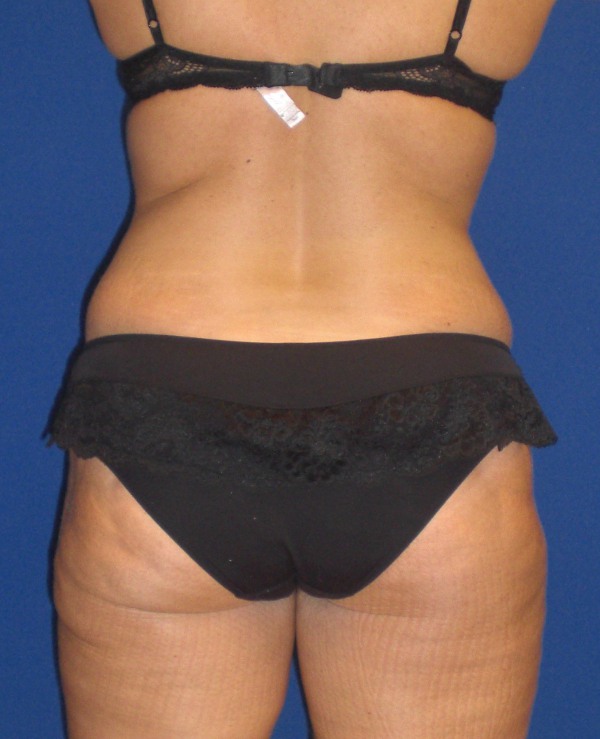 After Image