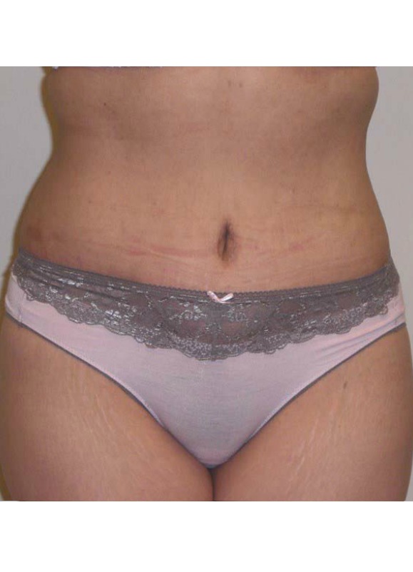 After Image