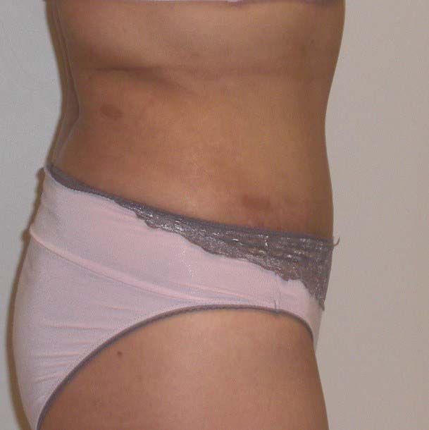 After Image