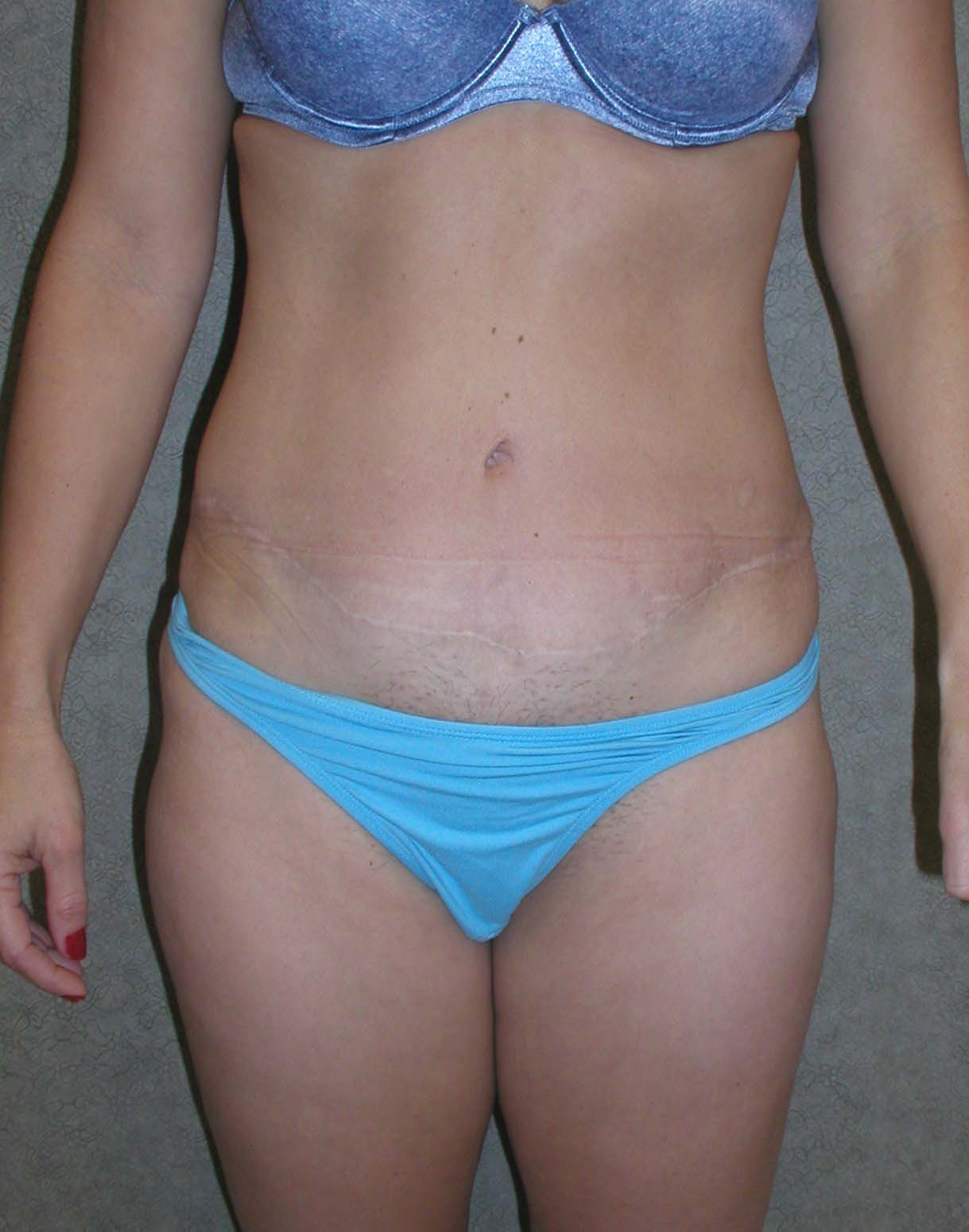After Image