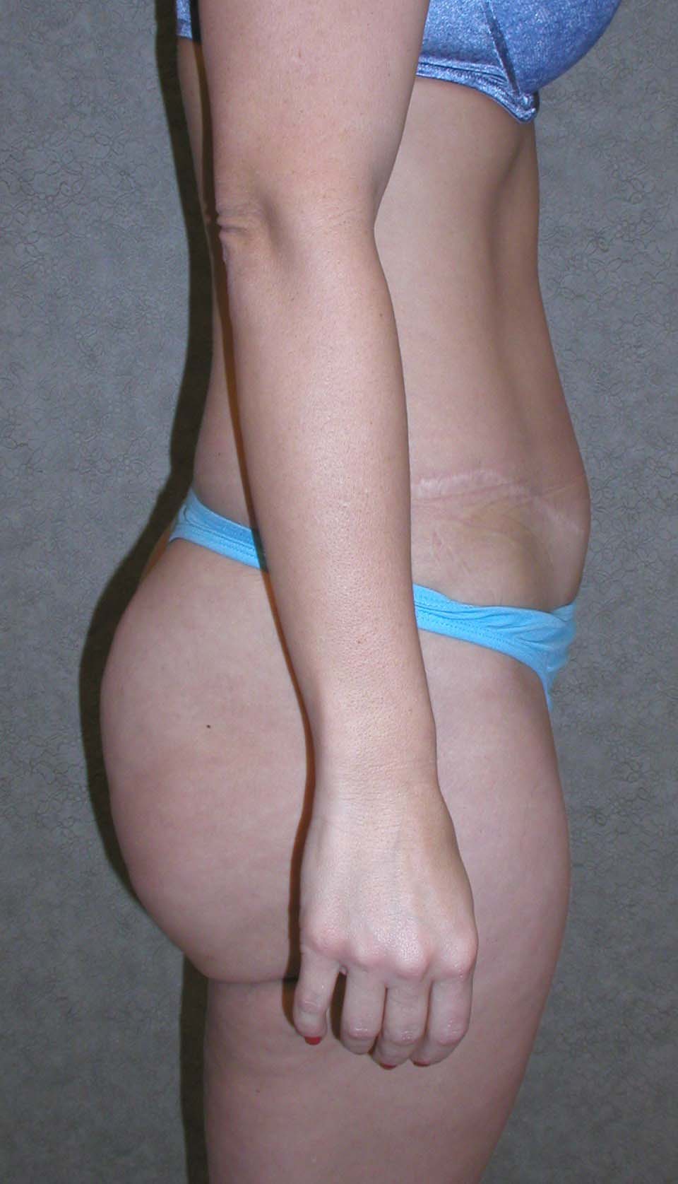 After Image