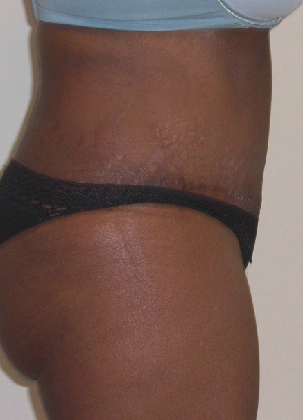 After Image