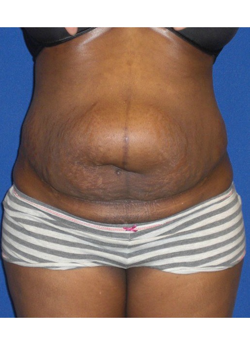 Before Image