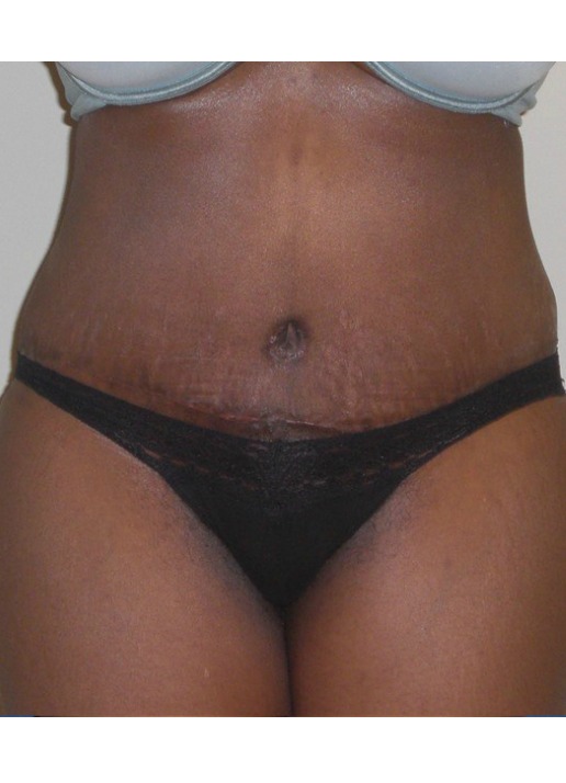 After Image