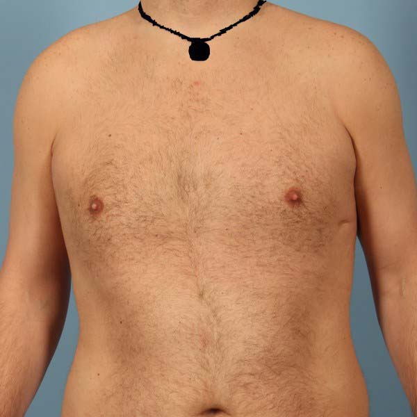 After Image