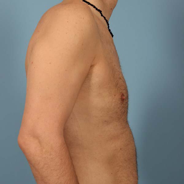 After Image
