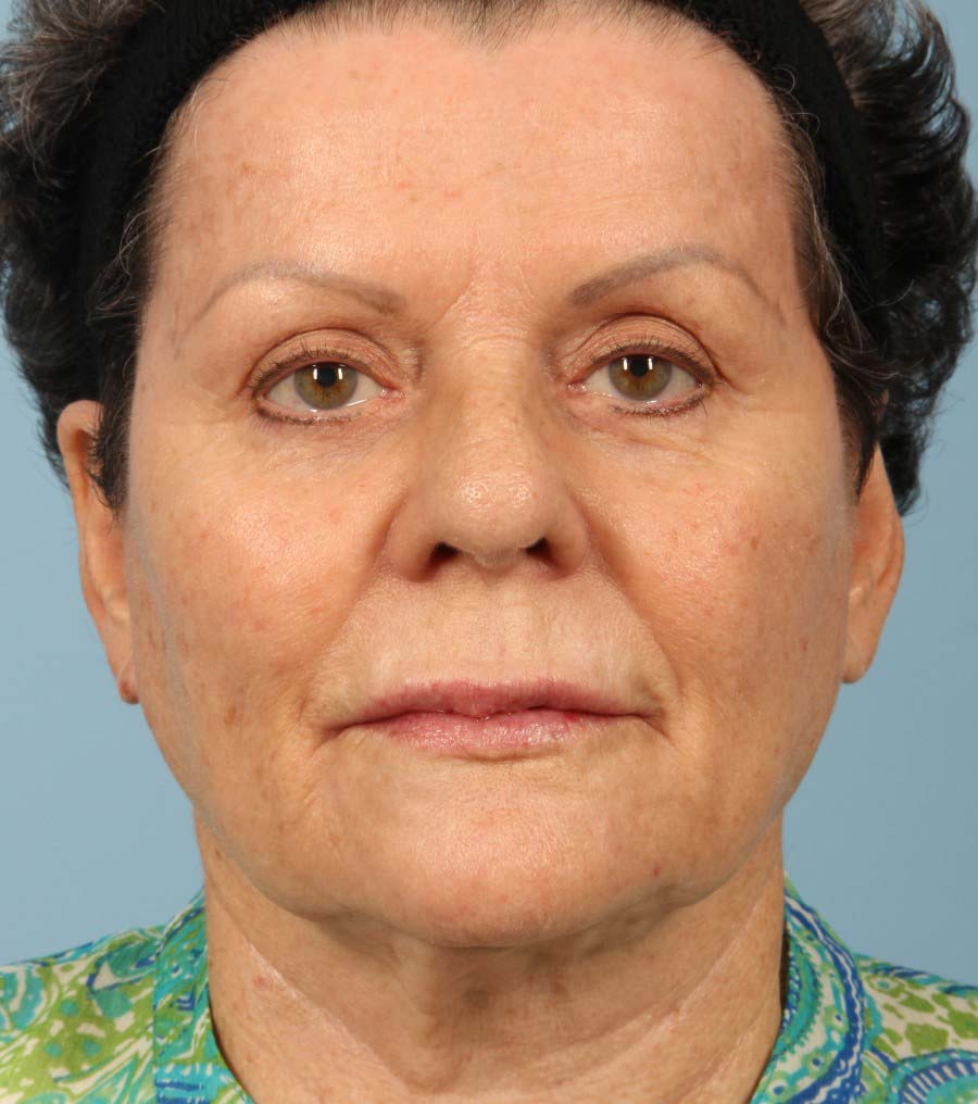 After Image