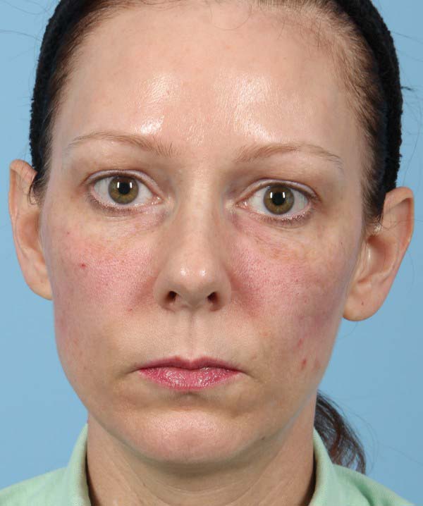 After Image