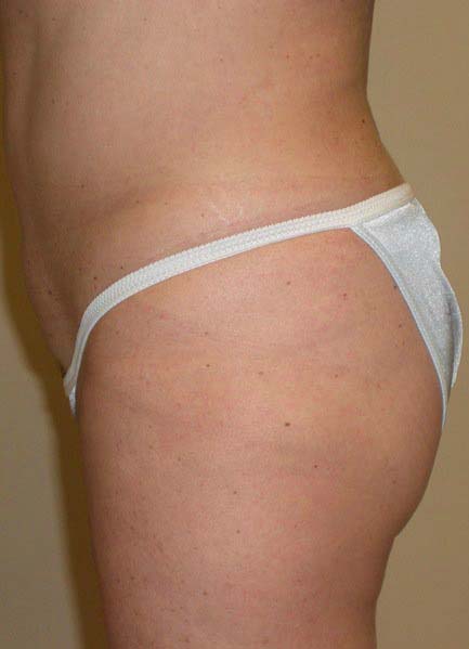 After Image