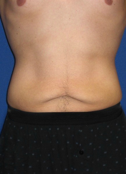 Before Image