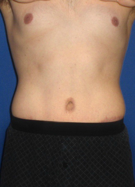 After Image