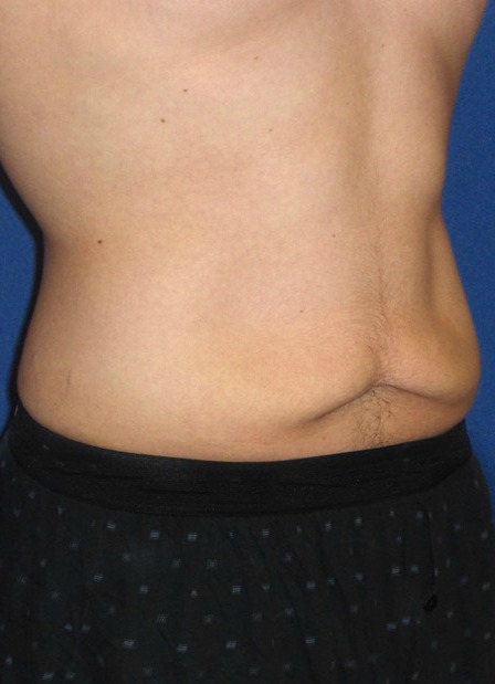 Before Image