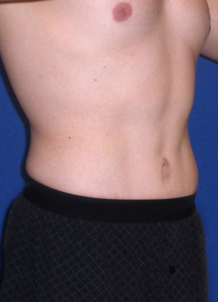 After Image