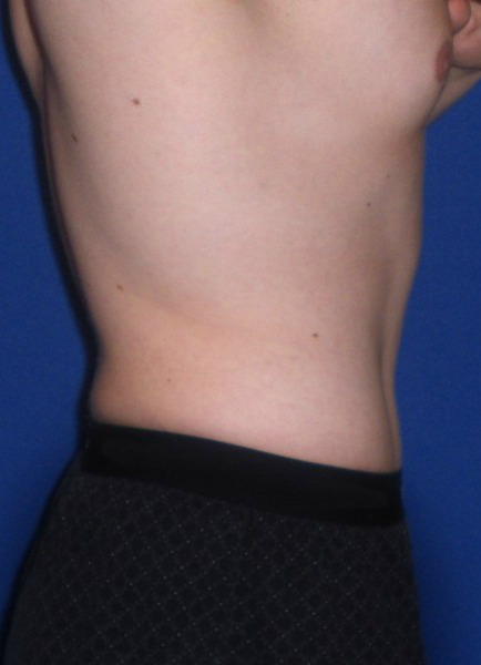 After Image