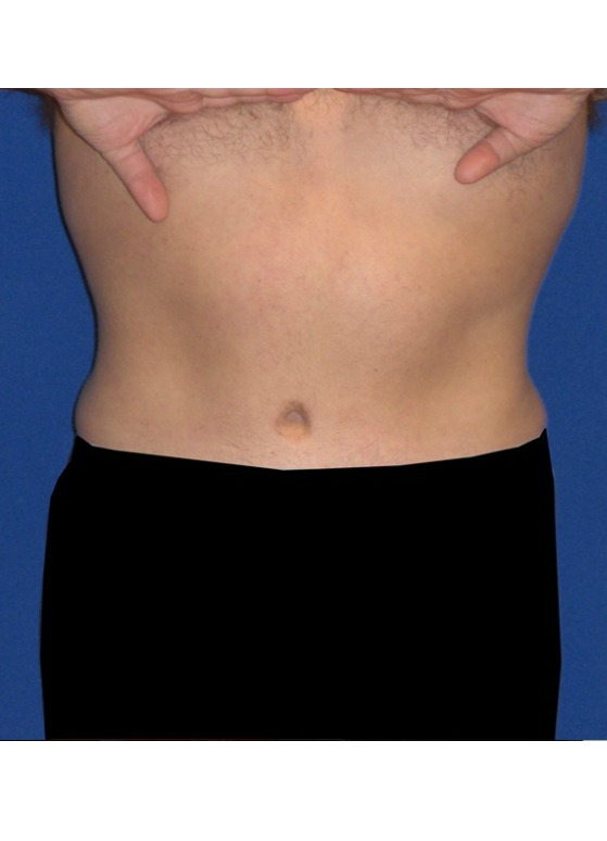 After Image