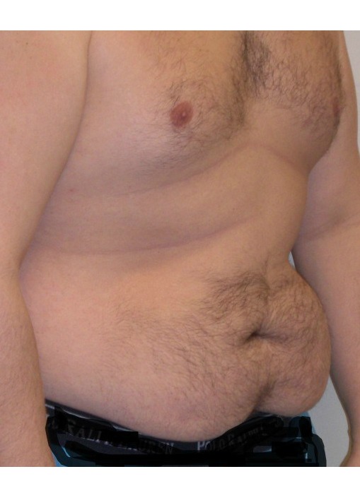 Before Image