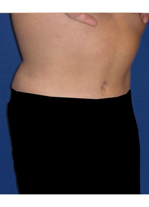 After Image