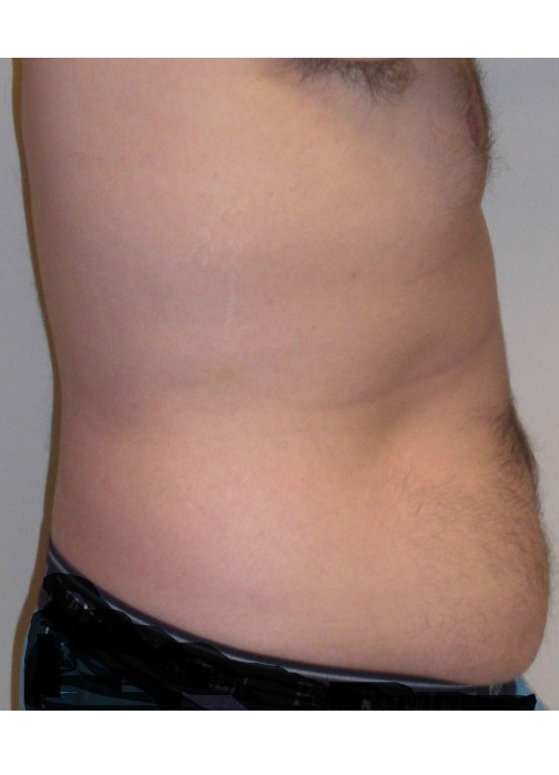 Before Image