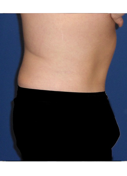 After Image