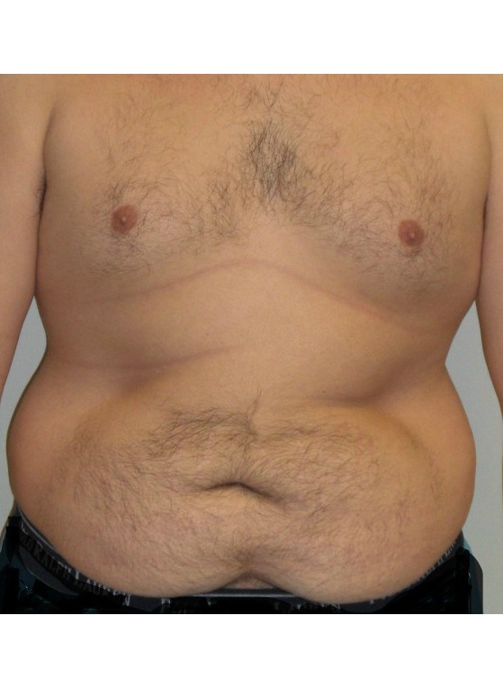Before Image