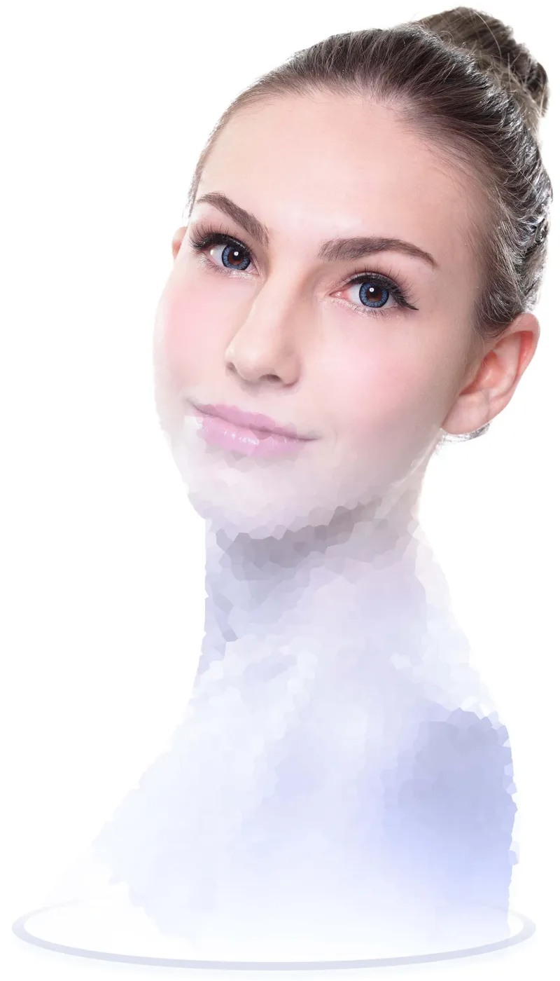 Vectra 3D