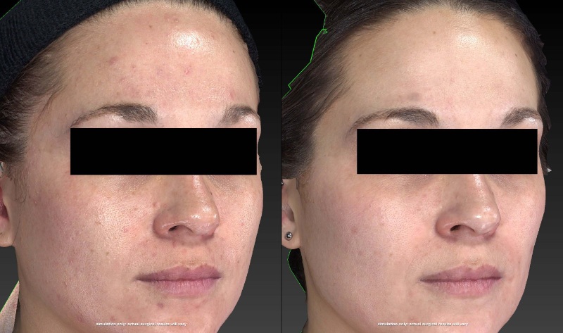 Youthful skin