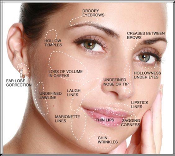 Botox and Fillers