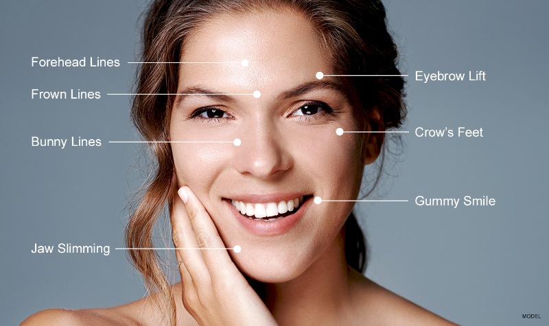 Botox and Fillers