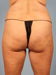 After Image
