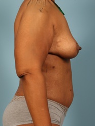 After Image