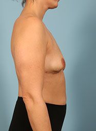 After Image