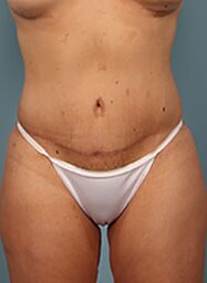 After Image