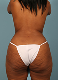 After Image
