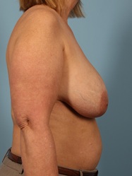 After Image