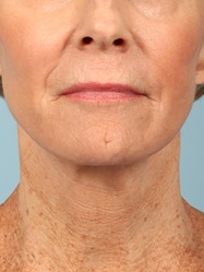 After Image