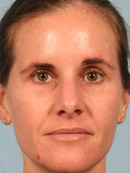 After Image