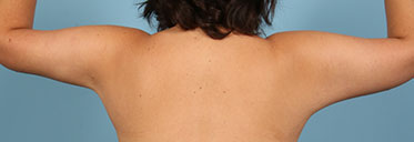 After Image