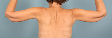 After Image