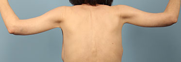 After Image
