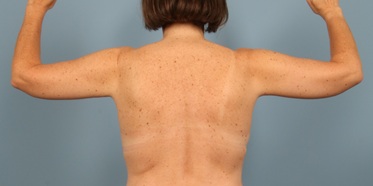 After Image