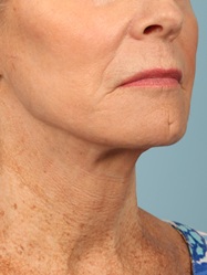 After Image