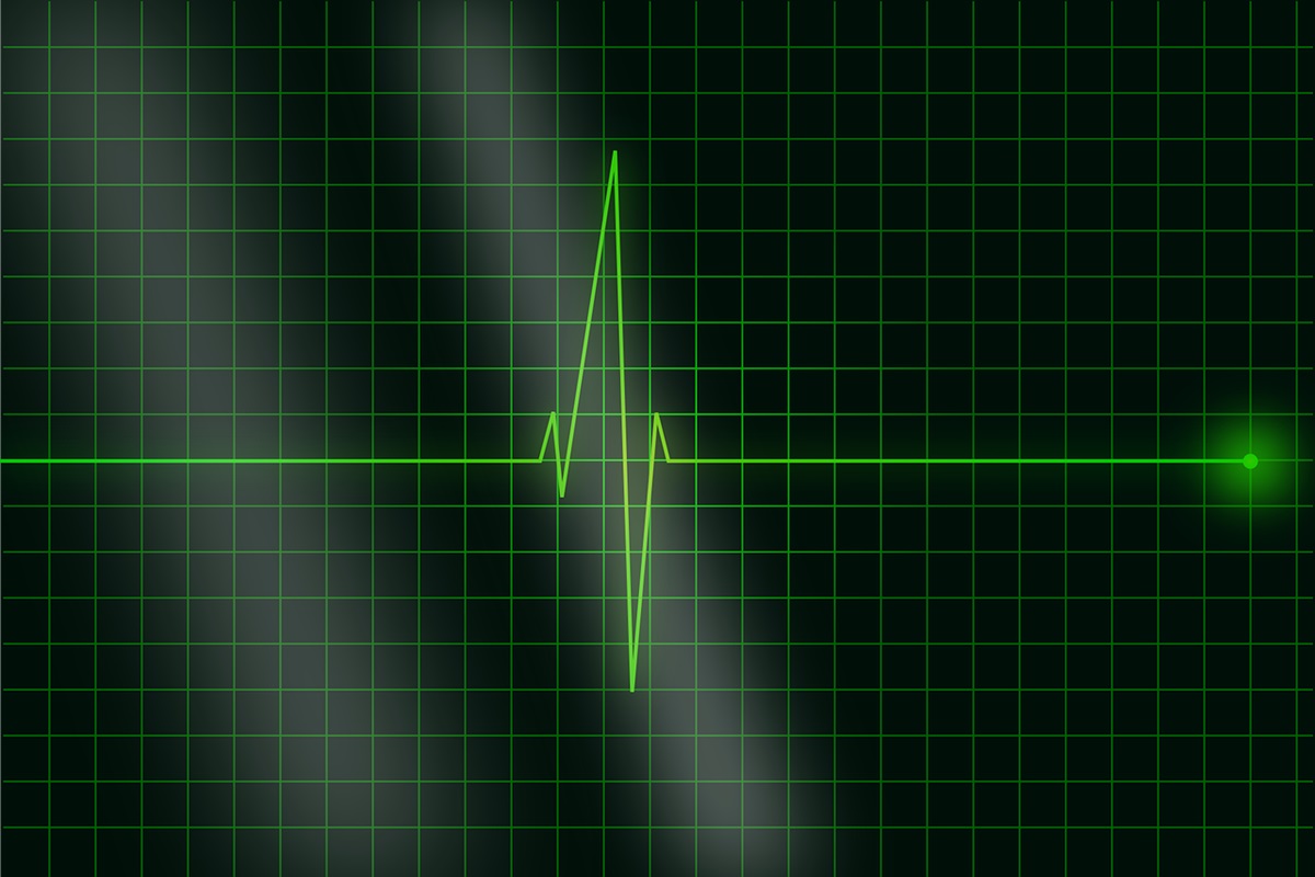 A green oscillation pattern.